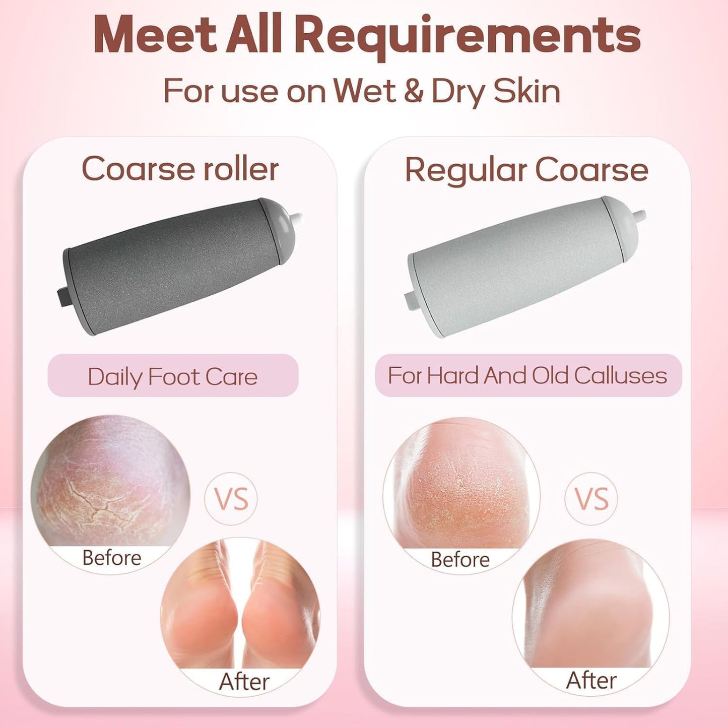 Cordless Electric Callus Remover – At‑Home Pedicure