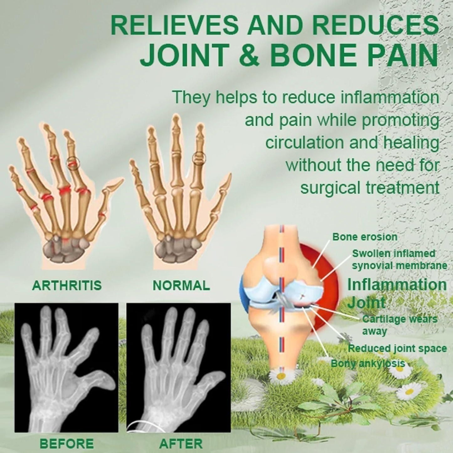 Bee Venom Ultra‑Strength Pain Relief Cream