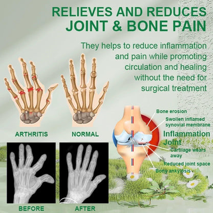 Bee Venom Ultra‑Strength Pain Relief Cream