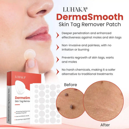 Skin Tag Remover Patches – Discreet, Easy‑Apply Strips
